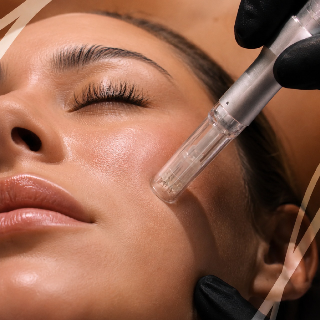 Facial Event: Save up to $100 on Microneedling! icon